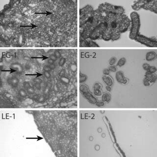 Isolation Of The Three Bovine Endometrial Cell Types By Lcm Stromal