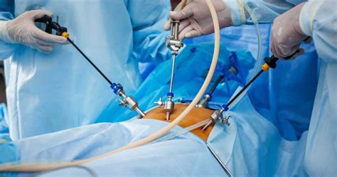 D Laparoscopy Laparoscopic Surgeons Kamla Nagar Hospital