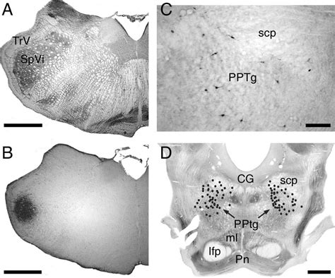 Retrograde Labeling Of PPTg Neurons After FG Injection In The SpVi A