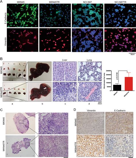 Trastuzumab Resistant Cells Are Highly Aggressive In Vivo A