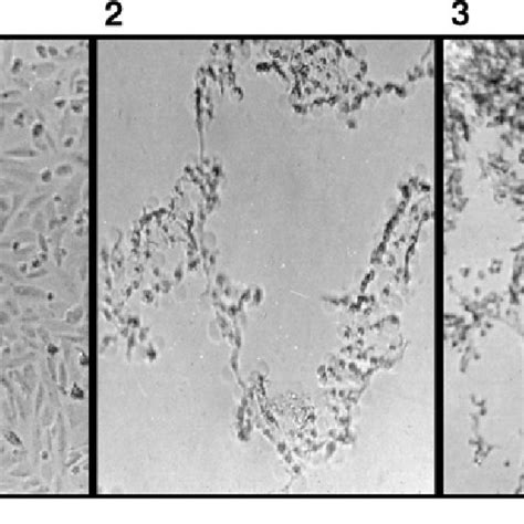 Photographs Showing The Cytotoxicity Of A Hydrophila Culture Filtrates