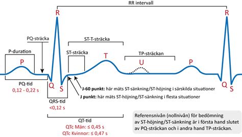 EKG tester föreläsningar Klinisk diagnostik