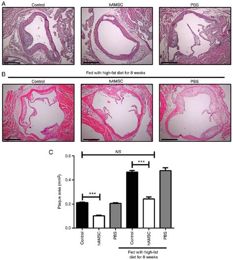 Figure From Human Amnion Mesenchymal Stem Cells Attenuate