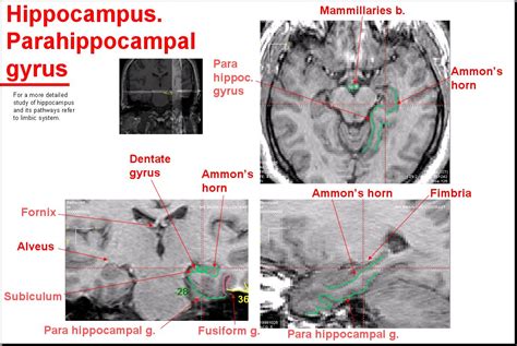 Salamon S Neuroanatomy And Neurovasculature Web Atlas Resource