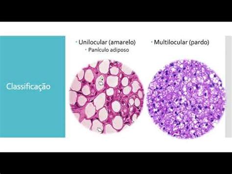 Histologia Do Tecido Adiposo YouTube