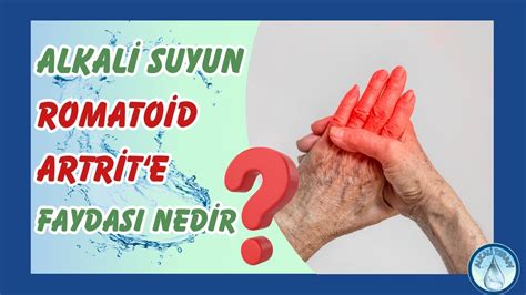 Canl Ve Alkali Suyun Iltihapl Romatizmaya Faydas Nedir Youtube