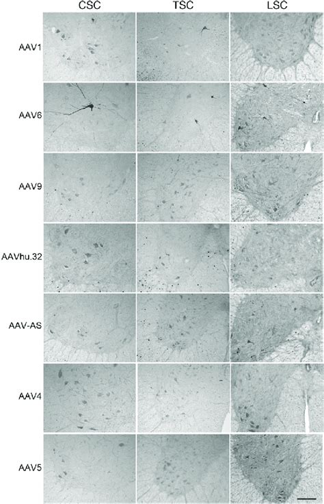 Transduction of motor neurons of the anterior horn of the spinal cord... | Download Scientific ...