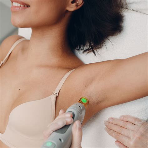 Splendor X By Lumenis Laser Hair Removal Safety And Long Term Results Cleveland Primecare Medspa