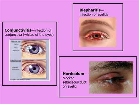 Ppt Administering Medications Powerpoint Presentation Free Download Id 5658118