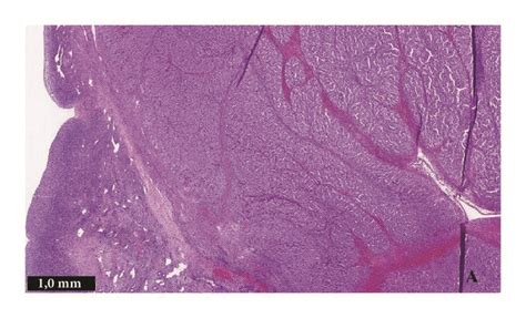 Hematoxylin And Eosin Staining Of The Surgical Specimen Download