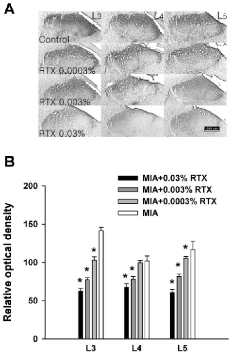 A A Representative Section Showing Cgrp Immunoreactivity In The