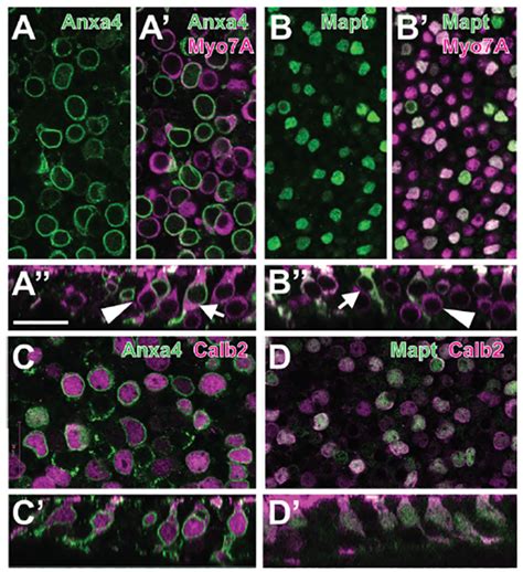 Mapt Mgi Mouse Gene Detail Mgi97180 Microtubule Associated Protein Tau