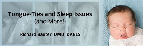 Tongue Ties And Sleep Issues And More Article Review