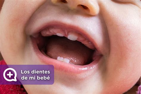 Los primeros dientes del bebé derribando mitos mediQuo