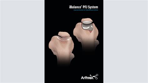 Arthrex IBalance PFJ System