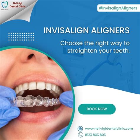 Invisalign Aligners Right Way To Straighten Your Teeth Nelivigi