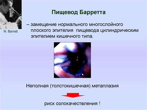 Гастроэзофагеальная рефлюксная болезнь - презентация онлайн
