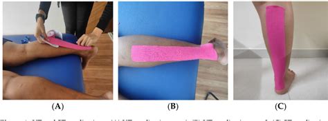 [pdf] The Time Based Effects Of Kinesio Taping On Acute Onset Muscle