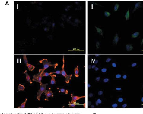 Figure 4 From Establishment Of Human Retinal Microvascular Endothelial