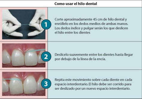 Odonto Salud Tecnica De Cepillado Correcta