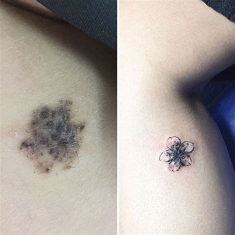 Tattoo Artist Makes Real Works Of Art Covering Sad Scars Tattoo Over