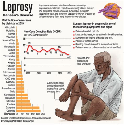 Alarm Over Return Of Leprosy Rising Cases Among Children Print