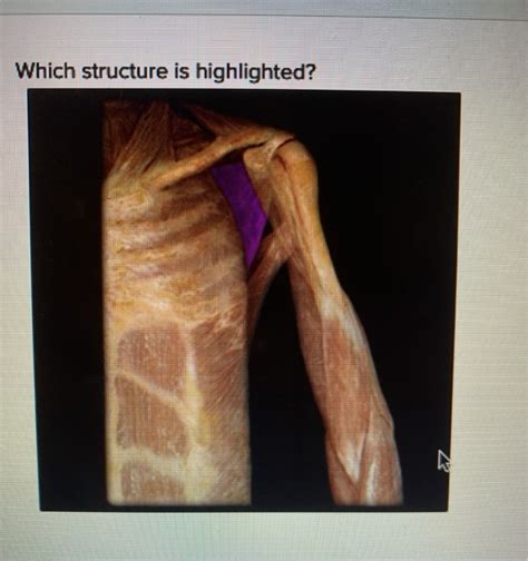 Solved Which Structure Is Highlighted O Supraspinatus Chegg