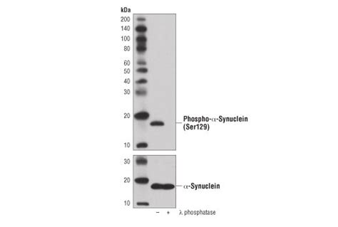 Phospho Alpha Synuclein Ser D R R Rabbit Mab L