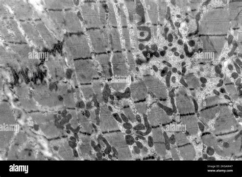 Transmission Electron Micrograph Tem Of A Section Through A Heart