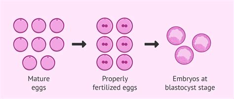 How Many Eggs Do You Need To Obtain To Perform IVF