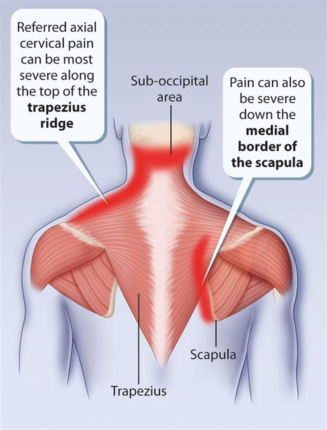 Shoulder Pain