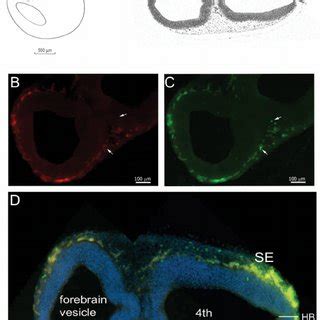 Ccr2 RFP Cx3cr1 GFP Cells Are Localized In The Neuroectoderm And