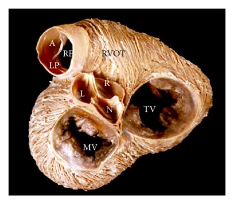 A B These Two Halves Of A Heart Are Bisected Longitudinally To Show