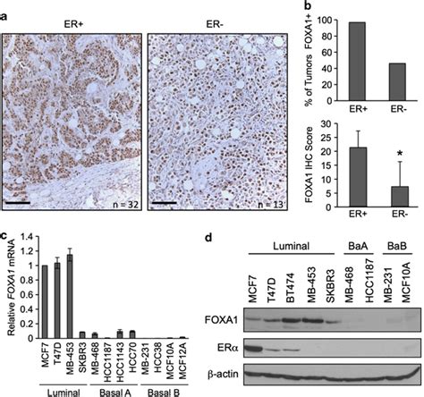 Foxa1 Is Expressed In The Absence Of Er In Breast Tumors And Luminal