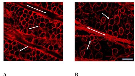 Figure 1 From Retinal Ganglion Cell Neuroprotection Induced By