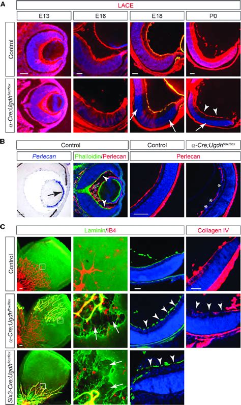 The Inner Limiting Membrane Is Disrupted In Proteoglycan Deficient
