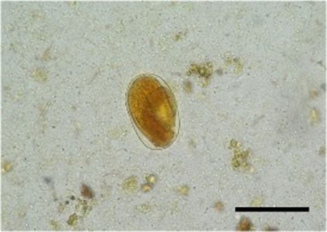 Ovo De Strongyloides Stercoralis Librain