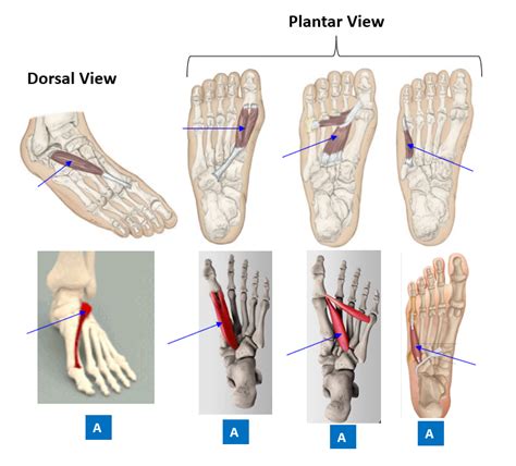 PHT1103 Anatomy PTA Foot Muscle Action And Labeling 6 Diagram Quizlet