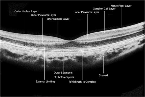 Outer Retinal Layers Oct