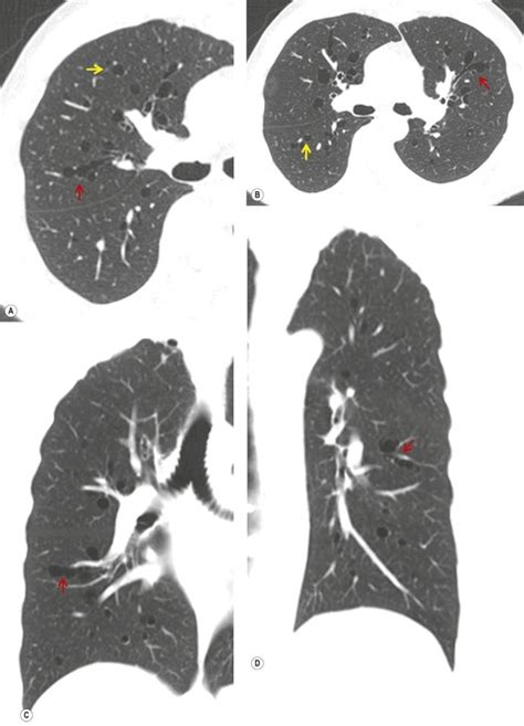 16 Congenital Anomalies Radiology Key