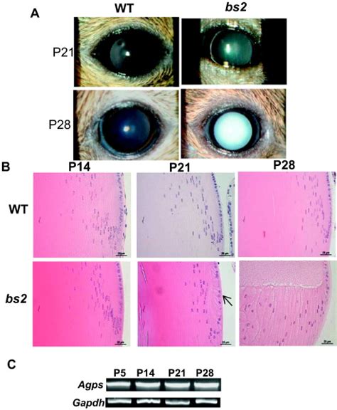 Cataracts In Bs2 Mice A Clinical Image Of Mild Nuclear Cataracts In