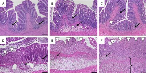 Histomorphology Of Colon Tissue In Dss Induced Colitis In C Bl