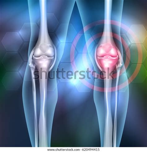 Leg Joint Anatomy 3d Illustration Beautiful Stock Vector (Royalty Free ...