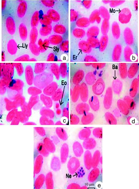 Morphology And Staining Characteristic Of A Large Lymphocytes Lly