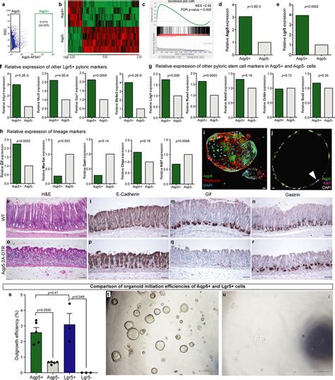 Detailed Characterization Of AQP5 Expressing Pyloric Cells By