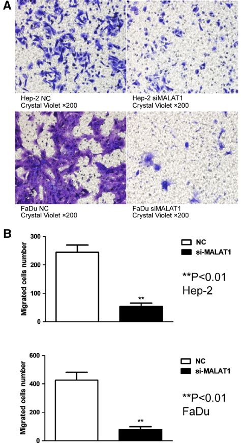 Silencing Expression Of Malat Impeded The Invasion And Migration Of