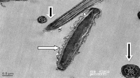 Transmission Electron Microphotograph Of Longitudinal Section Of Head