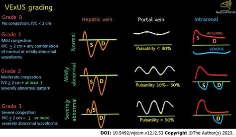 Venous Excess Ultrasound Grading When The Diameter Of The Inferior