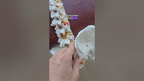 ГРЫЖА В ПОЯСНИЦЕ #кинезиология #грыжа #грыжапозвоночника - YouTube