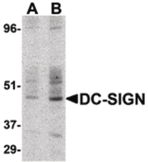 IHC Plus CD209 DC SIGN Polyclonal Antibody Rabbit Anti Human LSBio